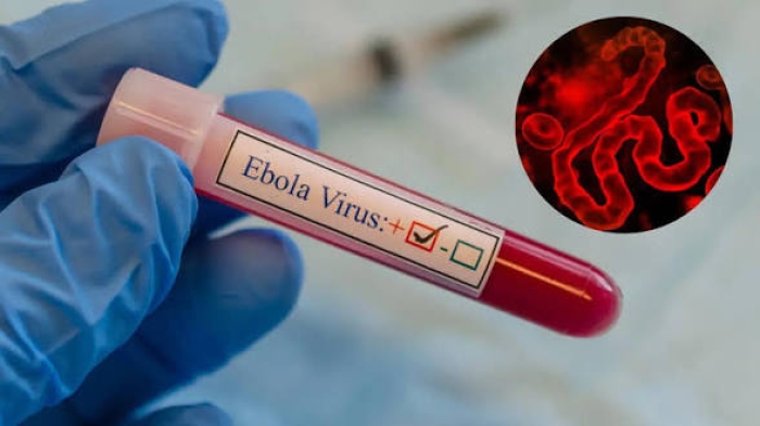 Ebola: WHO Cautions Against Panic, Says Fear is an Outbreak